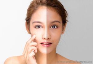 肌がたるむと顔がデカく見える（涙）大人女子のための“ハイライト”のススメ