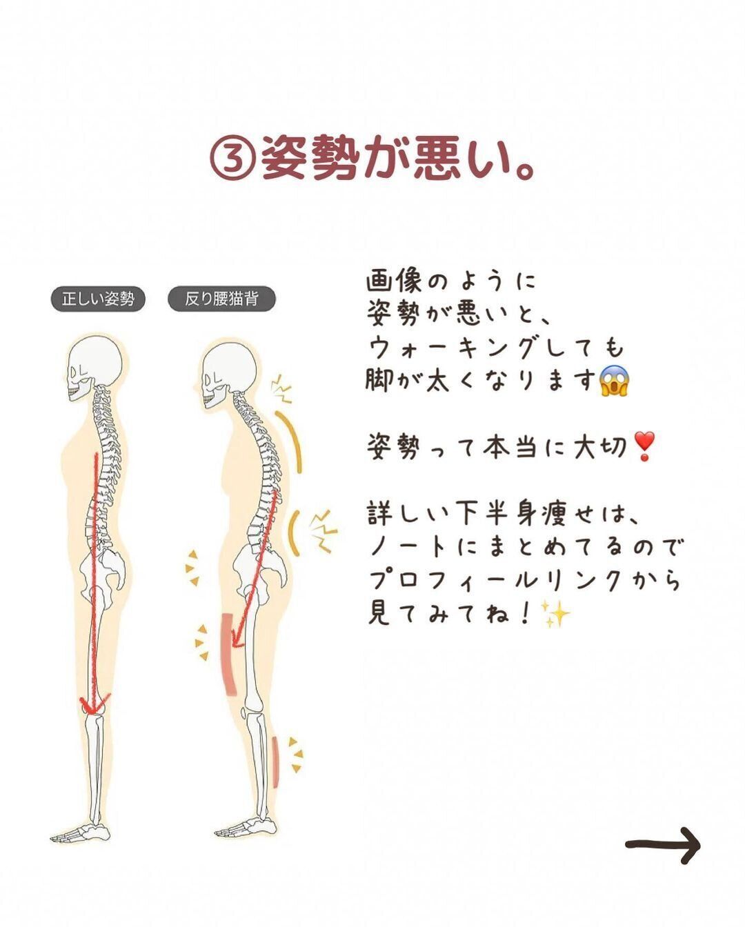 姿勢が悪いと足は痩せない