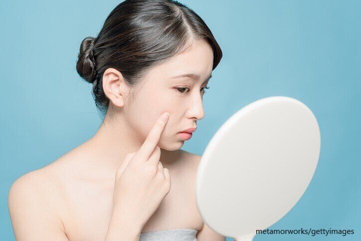 たるみ　ほうれい線