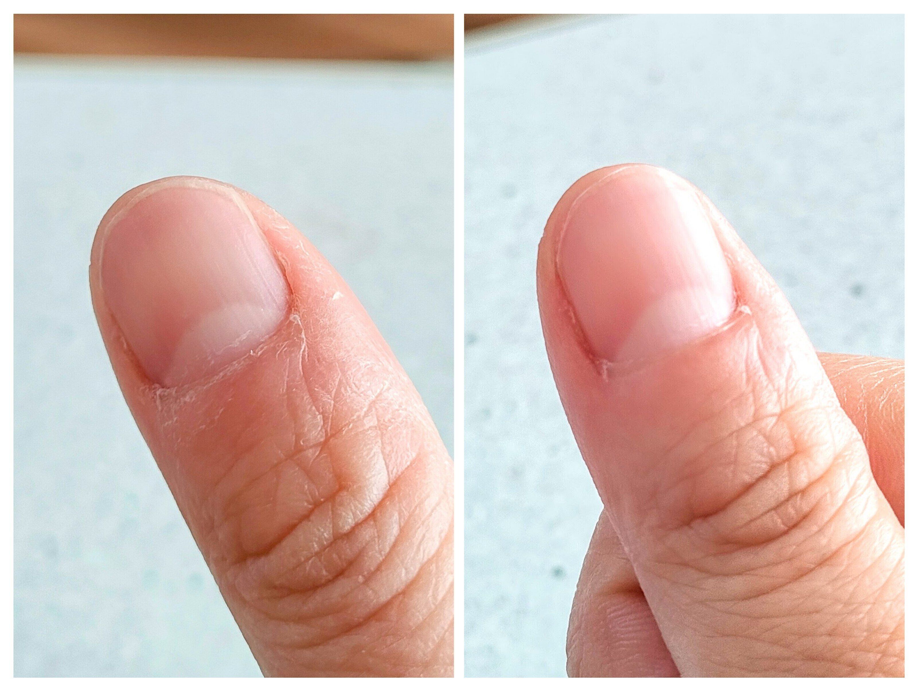 ビフォーアフター