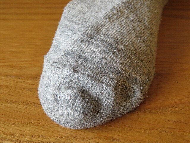 小さな穴ならつくろってみる