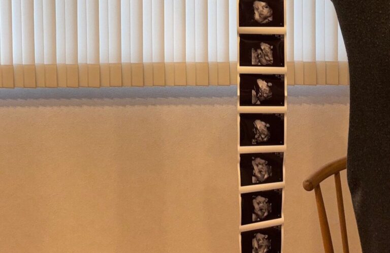 なが～いエコー写真にびっくり！妊婦の気持ちに寄り添い連写する産婦人科先生に感動の声と6.1万件のいいね