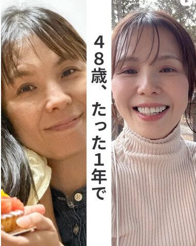 驚きのビフォーアフター