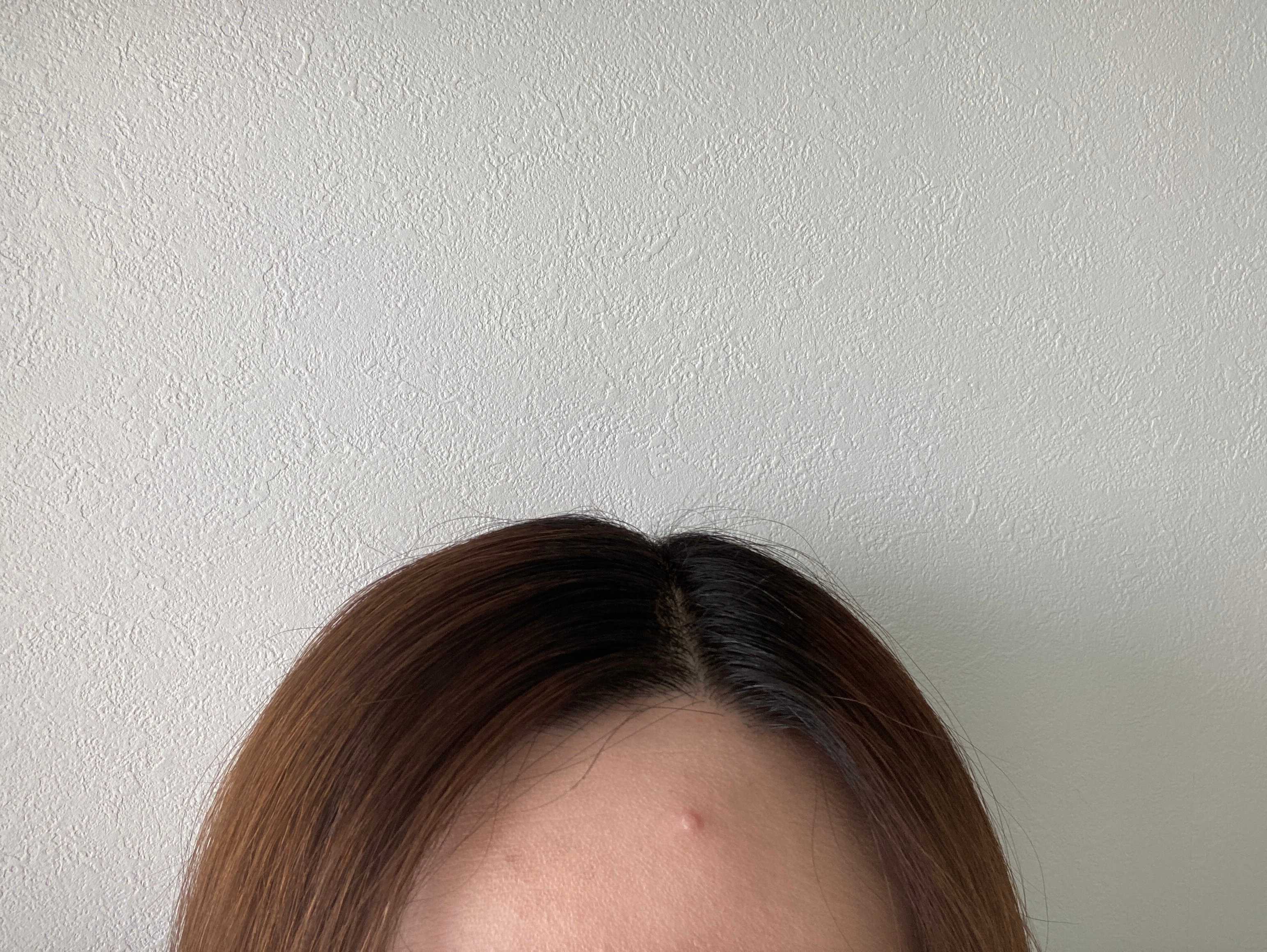 ポイントリペアでアホ毛を整えた頭部