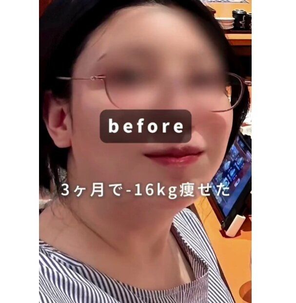 ビフォーアフター