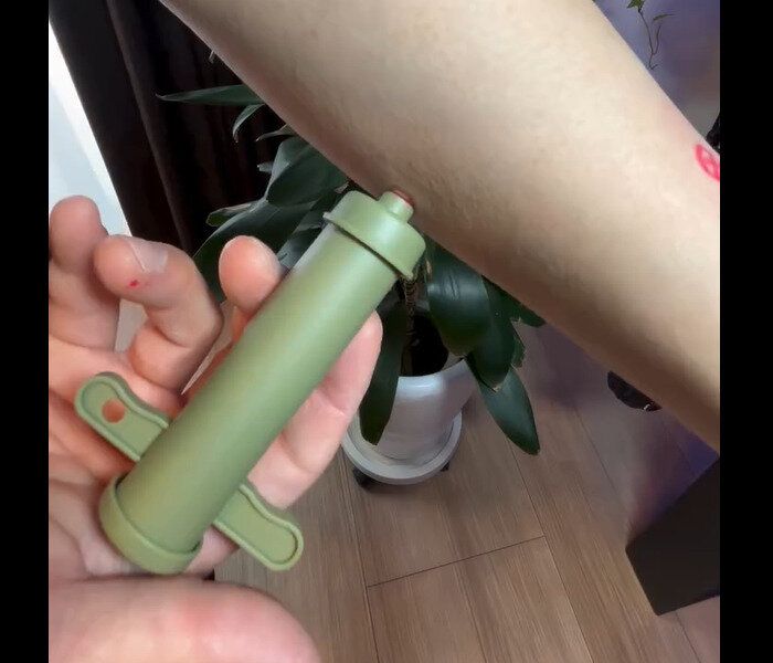 【ダイソー】毒を吸引！ポイズンリムーバー