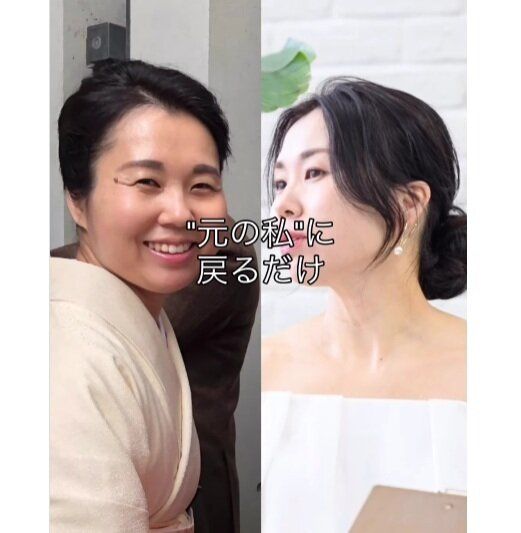 驚きのビフォーアフター