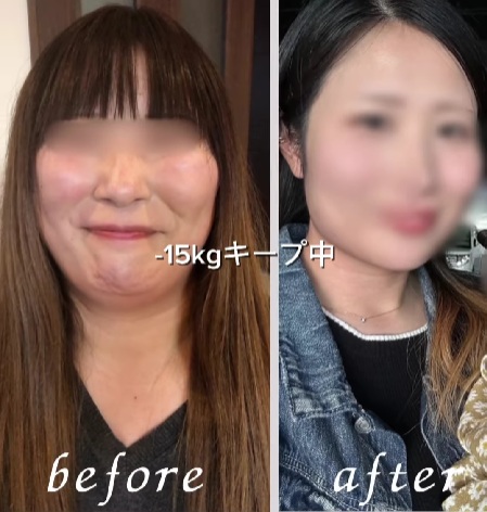 驚きのビフォアフター